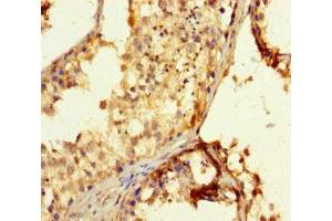 Immunohistochemistry of paraffin-embedded human testis tissue using ABIN7152285 at dilution of 1:100 (EXOSC3 antibody  (AA 2-275))