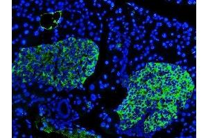 IF analysis of SYP using anti-SYP antibody (ABIN3042768).