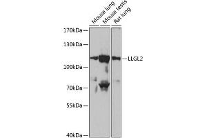 Western blot analysis of extracts of various cell lines, using LLGL2 antibody (ABIN6134714, ABIN6143260, ABIN6143263 and ABIN6217274) at 1:1000 dilution. (LLGL2 antibody  (AA 900-1000))
