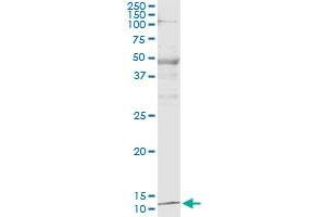 Immunoprecipitation of PTH transfected lysate using mouse monoclonal anti-PTH and Protein A Magnetic Bead (PTH (Human) IP-WB Antibody Pair)