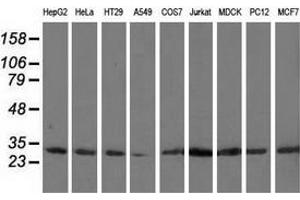 Western blot analysis of extracts (35 µg) from 9 different cell lines by using anti-CAPZA1 monoclonal antibody. (CAPZA1 antibody)