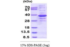 SDS-PAGE (SDS) image for Calcineurin-Like phosphoesterase Domain Containing 1 (Cpped1) (AA 1-314) protein (His tag) (ABIN5853023)