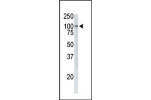 Western analysis of extracts from Jurkat cells using  antibody. (TPX2 antibody  (multi Epitope))