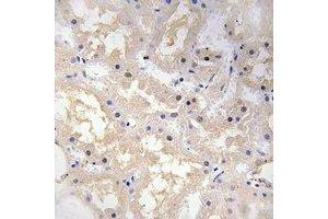 Immunohistochemical analysis of VIP staining in human kidney formalin fixed paraffin embedded tissue section. (Vip antibody)