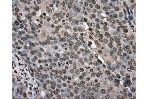 Immunohistochemical staining of paraffin-embedded colon tissue using anti-BSG mouse monoclonal antibody. (CD147 antibody)