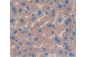 Figure. (SLC27A5 antibody  (AA 471-689))