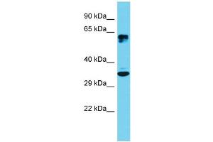 Western Blotting (WB) image for anti-Activating Transcription Factor 5 (ATF5) (N-Term) antibody (ABIN2777191)