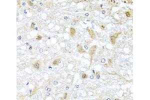 Immunohistochemistry of paraffin-embedded Rat brain using ATP2C1 Polyclonal Antibody at dilution of 1:100 (40x lens).