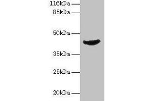 Western blot All lanes: ADA antibody at 2 μg/mL + Jurkat whole cell lysate Secondary Goat polyclonal to rabbit IgG at 1/10000 dilution Predicted band size: 41 kDa Observed band size: 41 kDa (ADA antibody  (AA 157-343))