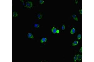 Immunofluorescent analysis of Hela cells using ABIN7156623 at dilution of 1:100 and Alexa Fluor 488-congugated AffiniPure Goat Anti-Rabbit IgG(H+L) (IRF5 antibody  (AA 214-395))