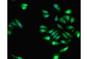 Immunofluorescence (IF) image for anti-ELAV (Embryonic Lethal, Abnormal Vision, Drosophila)-Like 4 (Hu Antigen D) (ELAVL4) (AA 1-150) antibody (ABIN7151487)