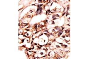Image no. 2 for anti-Death-Domain Associated Protein (DAXX) (pSer213) antibody (ABIN358116)
