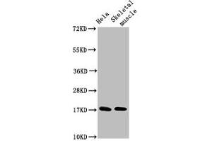 Western Blot Positive WB detected in: Hela whole cell lysate, Rat skeletal muscle tissue All lanes: UBE2D3 antibody at 4. (UBE2D3 antibody  (AA 1-147))