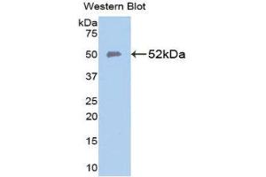 Western Blotting (WB) image for anti-Solute Carrier Family 40 (Iron-Regulated Transporter), Member 1 (SLC40A1) (AA 127-321) antibody (ABIN1111115) (SLC40A1 antibody  (AA 127-321))