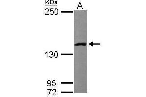 LRPPRC antibody