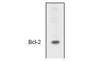 Image no. 1 for anti-B-Cell CLL/lymphoma 2 (BCL2) (N-Term) antibody (ABIN126981) (Bcl-2 antibody  (N-Term))