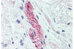 Image no. 3 for anti-Nestin (NES) antibody (ABIN108568) (Nestin antibody)