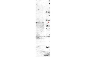 Western blot using  affinity purified anti-Nedd4 antibody shows detection of a 115 kDa band corresponding to endogenous Nedd4 (arrowhead) in MDA-MB-435S cell lysates. (NEDD4 antibody  (Internal Region))