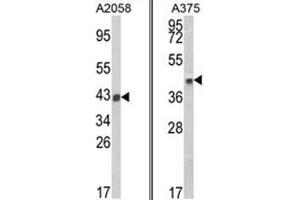 (LEFT) Western blot analysis of HLA-B Antibody (N-term) in A2058 cell line lysates (35ug/lane). (HLA B7 antibody  (N-Term))
