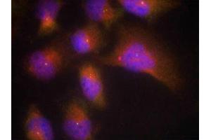 Immunofluorescence staining of methanol-fixed Hela cells using TrkB(Phospho-Tyr515) Antibody. (TRKB antibody  (pTyr515))