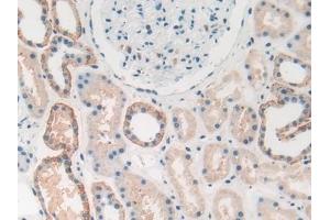 Detection of HMGB1 in Human Kidney Tissue using Polyclonal Antibody to High Mobility Group Protein 1 (HMGB1) (HMGB1 antibody  (AA 1-215))