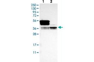 Western blot analysis of Lane 1: Human cell line RT-4 Lane 2: Human cell line U-251MG sp with HNRNPA1 polyclonal antibody  at 1:100-1:250 dilution. (HNRNPA1 antibody)