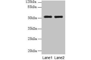 Western blot All lanes: WDR88 antibody at 6 μg/mL Lane 1: MCF-7 whole cell lysate Lane 2: A549 whole cell lysate Secondary Goat polyclonal to rabbit IgG at 1/10000 dilution Predicted band size: 53, 48 kDa Observed band size: 53 kDa (WDR88 antibody  (AA 1-250))