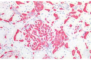 Immunohistochemistry staining of human kidney (paraffin-embedded sections) with anti-blood group A (HE-193), dilution 1:50. (ABO, Blood Group A Antigen antibody)