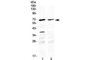 Western blot testing of human 1) HepG2 and 2) MCF7 cell lysate with MAK antibody at 0. (MAK antibody  (AA 588-623))
