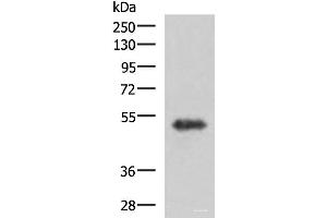 Western blot analysis of Human fetal brain tissue lysate using TSEN2 Polyclonal Antibody at dilution of 1:1000 (TSEN2 antibody)