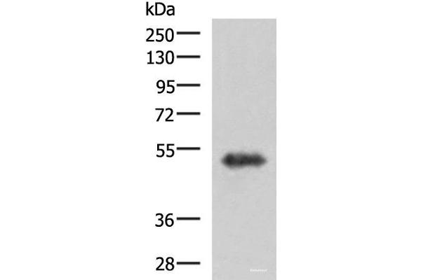 TSEN2 antibody