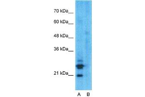 Western Blotting (WB) image for anti-Mucin 1 (MUC1) (C-Term) antibody (ABIN2776819)
