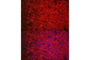 Immunofluorescence analysis of mouse brain cells using [KO Validated] βIII-Tubulin Mouse mAb  at dilution of 1:200 (40x lens). (TUBB3 antibody)