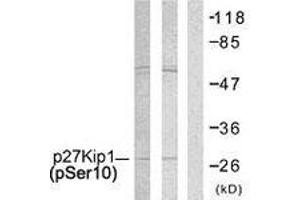 Western blot analysis of extracts from A2780 and COLO205 cells, using p27 Kip1 (Phospho-Ser10) Antibody. (CDKN1B antibody  (pSer10))