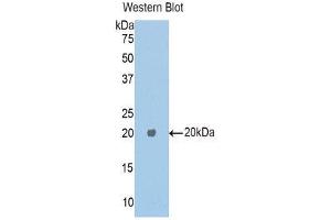 Western Blotting (WB) image for anti-Carboxypeptidase E (CPE) (AA 318-476) antibody (ABIN1176423) (CPE antibody  (AA 318-476))