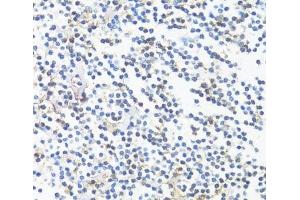 Immunohistochemistry of paraffin-embedded tonsil using HLA-DRB3 Polyclonal Antibody at dilution of 1:100 (40x lens). (HLA-DRB3 antibody)