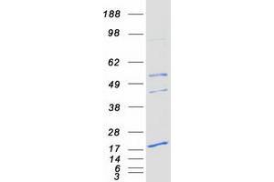 Validation with Western Blot (PEMT Protein (Transcript Variant 2) (Myc-DYKDDDDK Tag))