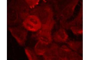 Immunofluorescence staining of methanol-fixed Hela cells using MEK-2(Phospho-Thr394) Antibody. (MEK2 antibody  (pThr394))