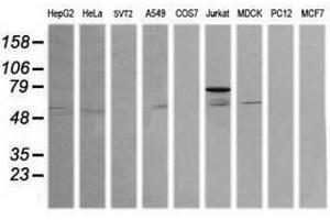 Image no. 4 for anti-ERG, ETS transcription factor (ERG) antibody (ABIN1498075)