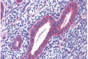 Human Uterus: Formalin-Fixed, Paraffin-Embedded (FFPE) (CCDC106 antibody  (C-Term))