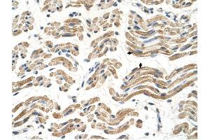ALDH4A1 antibody was used for immunohistochemistry at a concentration of 4-8 ug/ml to stain Skeletal muscle cells (arrows) in Human Muscle. (ALDH4A1 antibody  (C-Term))