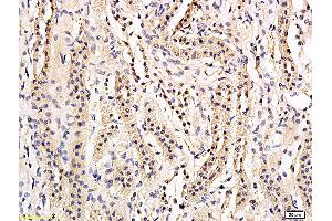 Formalin-fixed and paraffin embedded rat kidney labeled with Anti-phospho-AQP2(Ser269) Polyclonal Antibody, Unconjugated (ABIN756127) followed by conjugation to the secondary antibody and DAB staining (AQP2 antibody  (pSer269))