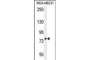 SORBS1 Antibody (Center) (ABIN654646 and ABIN2844342) western blot analysis in MDA-M cell line lysates (35 μg/lane).