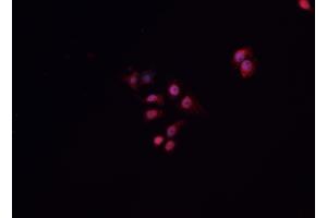 ABIN6268941 staining A549 cells by IF/ICC. (HNF1B antibody  (Internal Region))