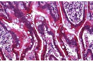 Human Intestine: Formalin-Fixed, Paraffin-Embedded (FFPE) (GPR137C antibody  (AA 256-305))
