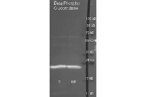 Goat anti antibody ( was used to detect purified Beta Phospho Glucomutase under reducing (R) and non-reducing (NR) conditions. (Beta-Phosphoglucomutase antibody  (HRP))