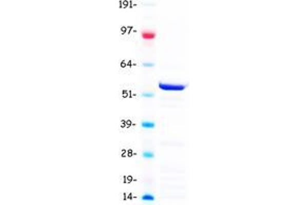 TBL1Y Protein (Transcript Variant 2) (Myc-DYKDDDDK Tag)