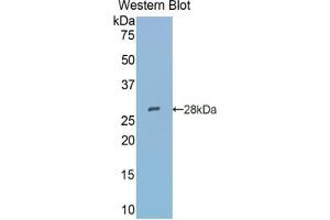 Western blot analysis of the recombinant protein. (SIGLEC5 antibody  (AA 147-335))