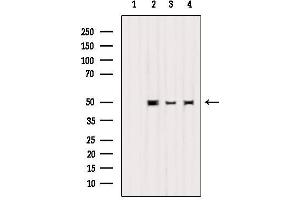 Western blot analysis of extracts from various samples, using K1H2 Antibody. (KRT32 antibody  (Internal Region))
