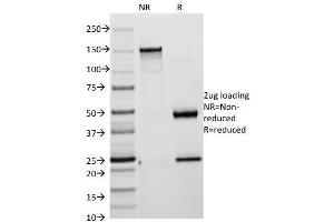 SDS-PAGE Analysis of Purified Cytokeratin 18 Mouse Monoclonal Antibody (KRT18/835). (KRT8, KRT18 antibody)